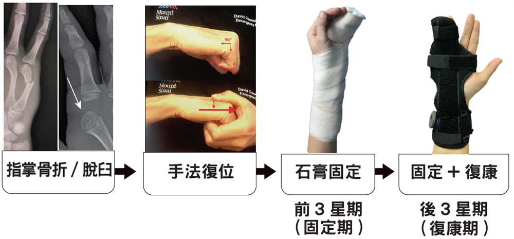 Conservative treatment flow 2